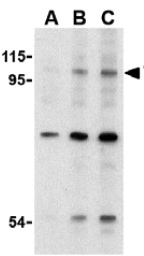 Western blot - Anti-TLR6 antibody (AB37072), expandable thumbnail