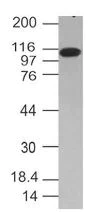 Western blot - Anti-TLR6 antibody [ABM1B50] (AB228424)
