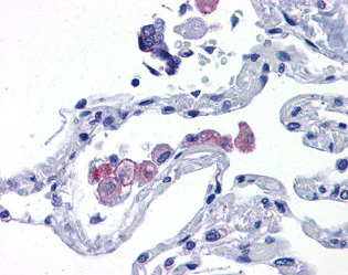 Immunohistochemistry (Formalin/PFA-fixed paraffin-embedded sections) - Anti-TLR7 antibody (AB113524)