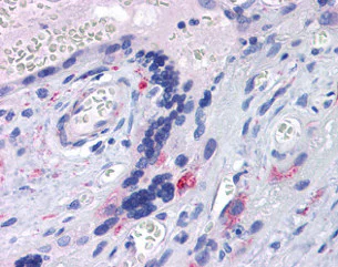 Immunohistochemistry (Formalin/PFA-fixed paraffin-embedded sections) - Anti-TLR7 antibody (AB113524)