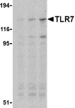 Western blot - Anti-TLR7 antibody (AB24184)
