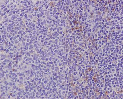 Immunohistochemistry (Formalin/PFA-fixed paraffin-embedded sections) - Anti-TLR7 antibody [EPR2088(2)] (AB124928)