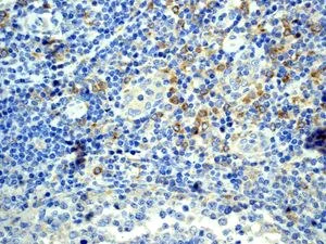 Immunohistochemistry (Formalin/PFA-fixed paraffin-embedded sections) - Anti-TLR7 antibody [EPR2088(2)] (AB124928)