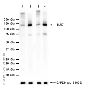Western blot - Anti-TLR7 antibody [EPR2088(2)] (AB124928)