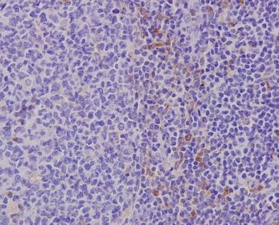 Immunohistochemistry (Formalin/PFA-fixed paraffin-embedded sections) - Anti-TLR7 antibody [EPR2088(2)] - BSA and Azide free (AB210403)