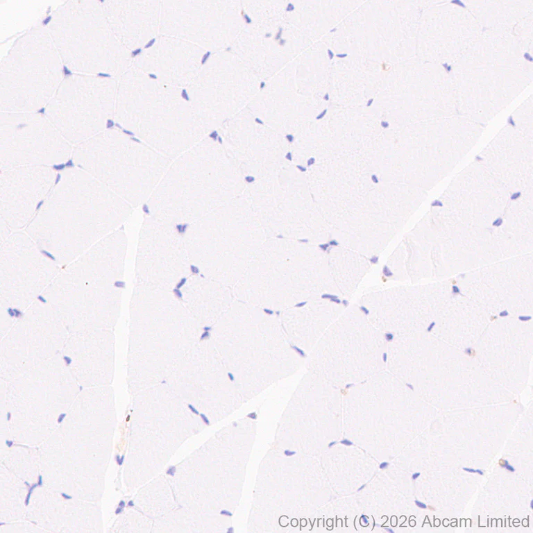 Immunohistochemistry (Formalin/PFA-fixed paraffin-embedded sections) - Anti-TLR7 antibody [EPR26195-250] (AB325746)