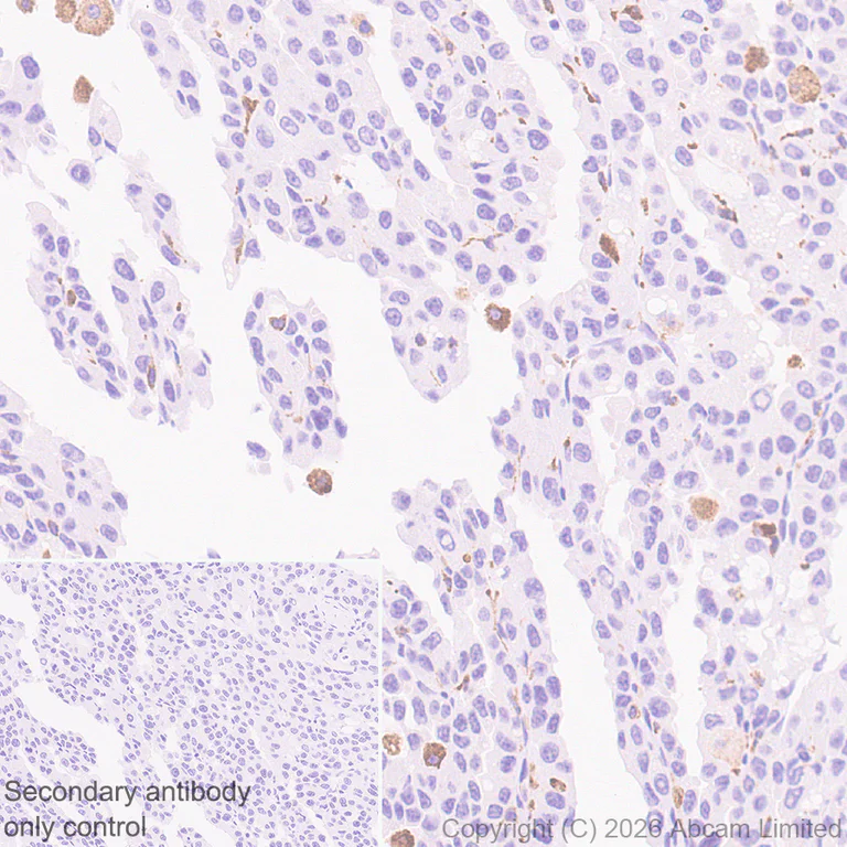Immunohistochemistry (Formalin/PFA-fixed paraffin-embedded sections) - Anti-TLR7 antibody [EPR26195-250] - BSA and Azide free (AB325756)