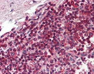 Immunohistochemistry (Formalin/PFA-fixed paraffin-embedded sections) - Anti-TLR8 antibody [44C143] (AB85859)