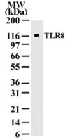 Western blot - Anti-TLR8 antibody [44C143] (AB85859)