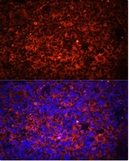 Immunocytochemistry/ Immunofluorescence - Anti-TLR8 antibody (AB180610)
