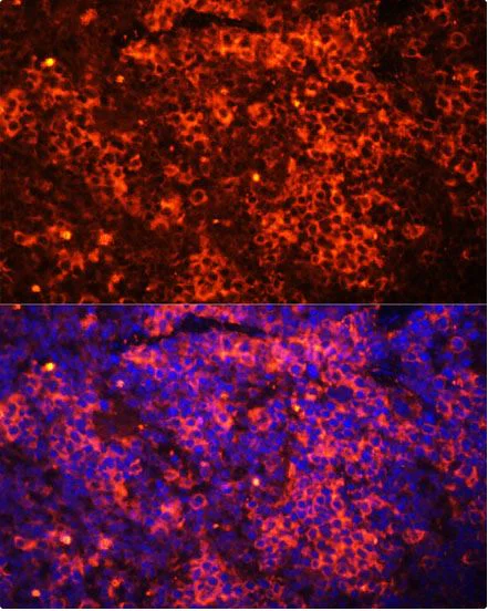 Immunocytochemistry/ Immunofluorescence - Anti-TLR8 antibody (AB180610)