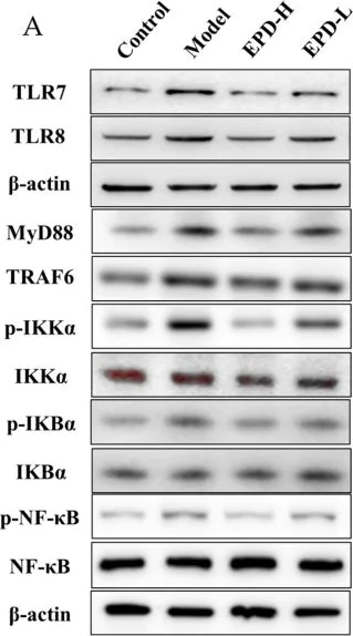 Western blot - Anti-TLR8 antibody (AB180610)