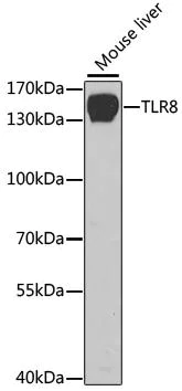 Western blot - Anti-TLR8 antibody (AB180610)