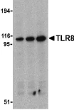 Western blot - Anti-TLR8 antibody (AB24185)