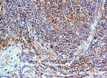 Immunohistochemistry (Formalin/PFA-fixed paraffin-embedded sections) - Anti-TLR8 antibody (AB53630)