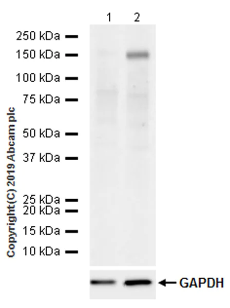 Western blot - Anti-TLR8 antibody [EPR22848-74] (AB228962)