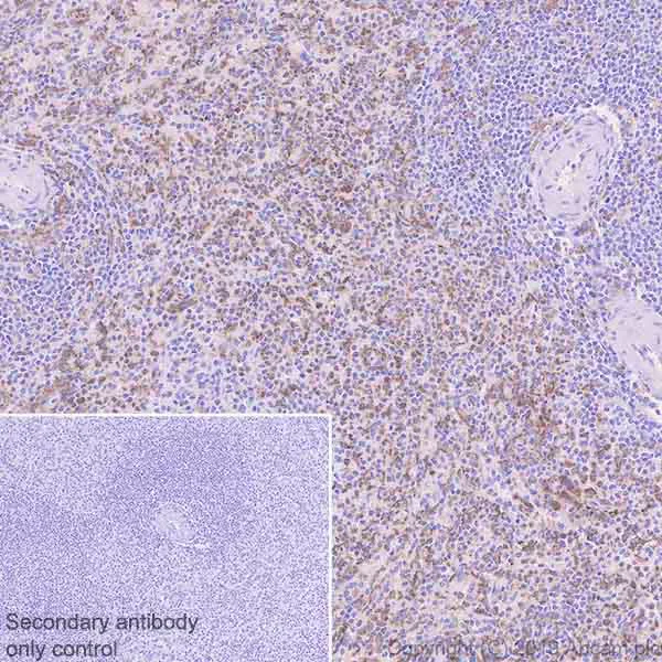 Immunohistochemistry (Formalin/PFA-fixed paraffin-embedded sections) - Anti-TLR8 antibody [EPR22848-74] - BSA and Azide free (AB260002)
