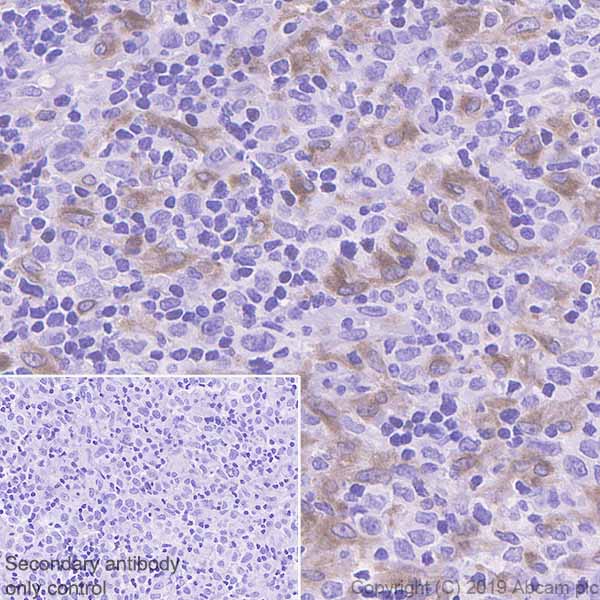 Immunohistochemistry (Formalin/PFA-fixed paraffin-embedded sections) - Anti-TLR8 antibody [EPR22848-74] - BSA and Azide free (AB260002), expandable thumbnail