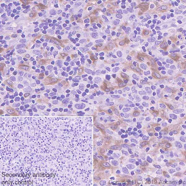 Immunohistochemistry (Formalin/PFA-fixed paraffin-embedded sections) - Anti-TLR8 antibody [EPR22848-74] - BSA and Azide free (AB260002)