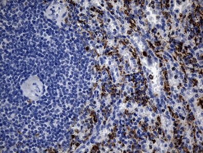 Immunohistochemistry (Formalin/PFA-fixed paraffin-embedded sections) - Anti-TLR8 antibody [OTI4F3] (AB236521)
