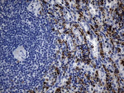 Immunohistochemistry (Formalin/PFA-fixed paraffin-embedded sections) - Anti-TLR8 antibody [OTI4F3] (AB236521)