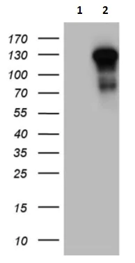 Western blot - Anti-TLR8 antibody [OTI4F3] (AB236521)