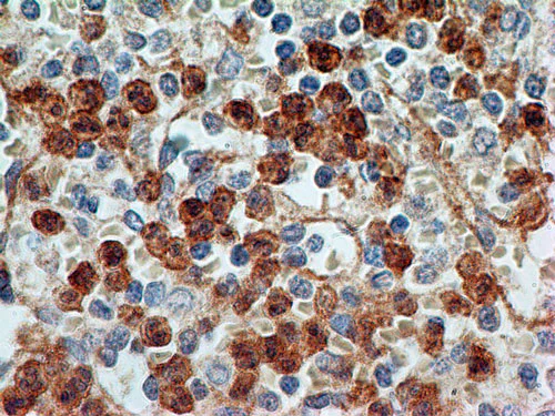 Immunohistochemistry (Formalin/PFA-fixed paraffin-embedded sections) - Anti-TLR9 antibody [26C593.2] (AB134368)