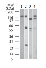 Western blot - Anti-TLR9 antibody [26C593.2] (AB134368)