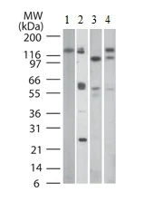 Western blot - Anti-TLR9 antibody [26C593.2] (AB134368)