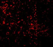 Immunocytochemistry/ Immunofluorescence - Anti-TLR9 antibody (AB37154)