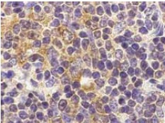 Immunohistochemistry (Formalin/PFA-fixed paraffin-embedded sections) - Anti-TLR9 antibody (AB37154)