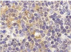 Immunohistochemistry (Formalin/PFA-fixed paraffin-embedded sections) - Anti-TLR9 antibody (AB37154)
