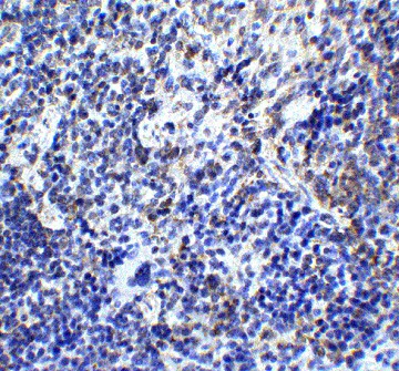 Immunohistochemistry (Formalin/PFA-fixed paraffin-embedded sections) - Anti-TLR9 antibody (AB37154)