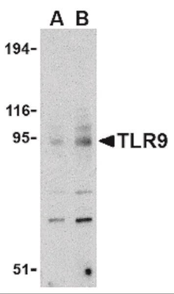 Western blot - Anti-TLR9 antibody (AB37154)
