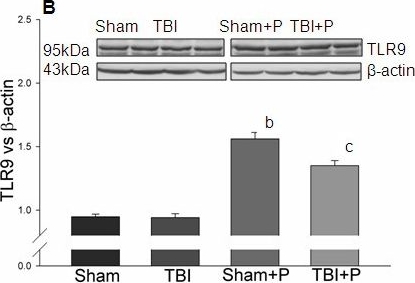 Anti-TLR9 antibody