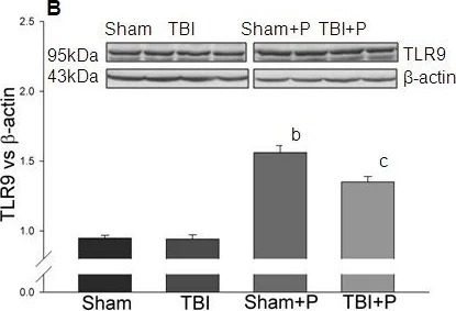 Western blot - Anti-TLR9 antibody (AB37154)