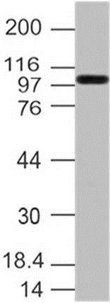 Western blot - Anti-TLR9 antibody [ABM4D70] (AB210930)