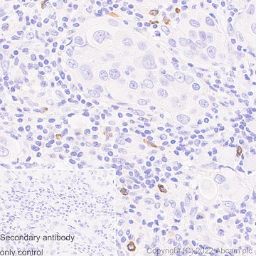 Immunohistochemistry (Formalin/PFA-fixed paraffin-embedded sections) - Anti-TLR9 antibody [EPR14964-2] (AB187148)