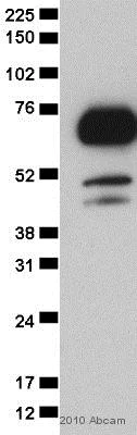 Western blot - Anti-TLS/FUS antibody (AB23439)