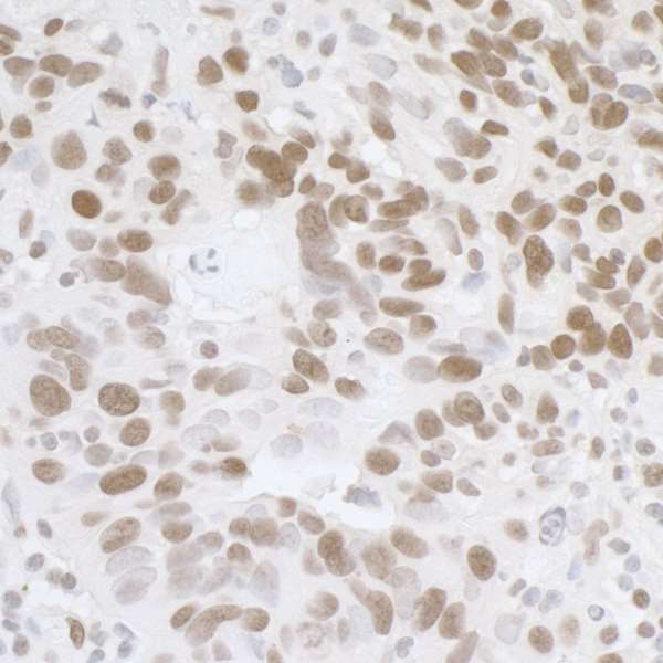 Immunohistochemistry (Formalin/PFA-fixed paraffin-embedded sections) - Anti-TLS/FUS antibody (AB245332)