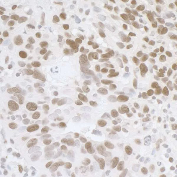 Immunohistochemistry (Formalin/PFA-fixed paraffin-embedded sections) - Anti-TLS/FUS antibody (AB245332)