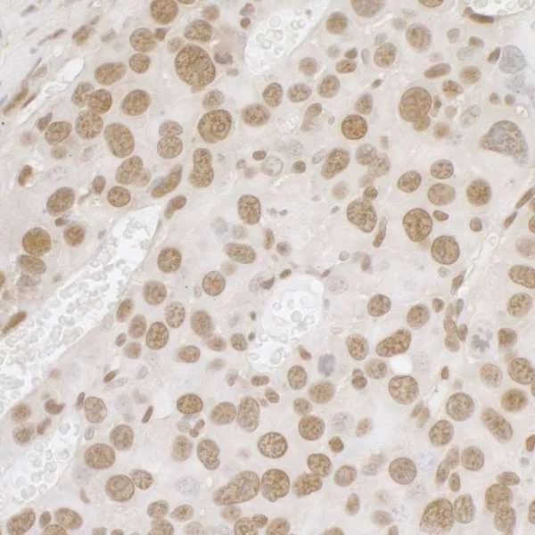 Immunohistochemistry (Formalin/PFA-fixed paraffin-embedded sections) - Anti-TLS/FUS antibody (AB245332)