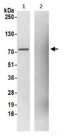 Immunoprecipitation - Anti-TLS/FUS antibody (AB245332)