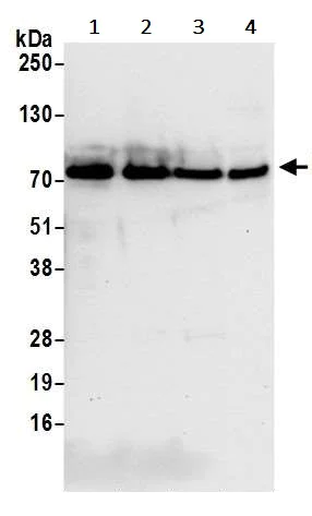 Western blot - Anti-TLS/FUS antibody (AB245332)