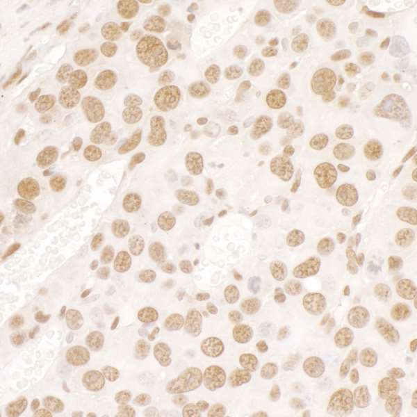 Anti-TLS/FUS antibody