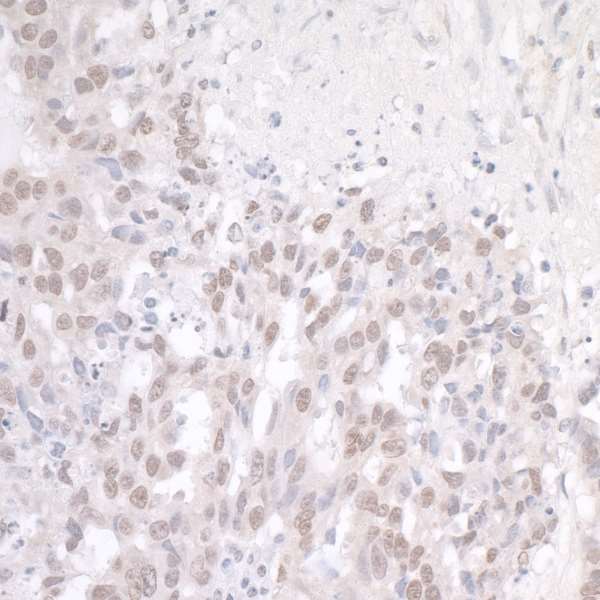 Immunohistochemistry (Formalin/PFA-fixed paraffin-embedded sections) - Anti-TLS/FUS antibody (AB84078)