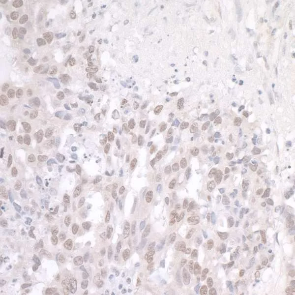 Immunohistochemistry (Formalin/PFA-fixed paraffin-embedded sections) - Anti-TLS/FUS antibody (AB84078)