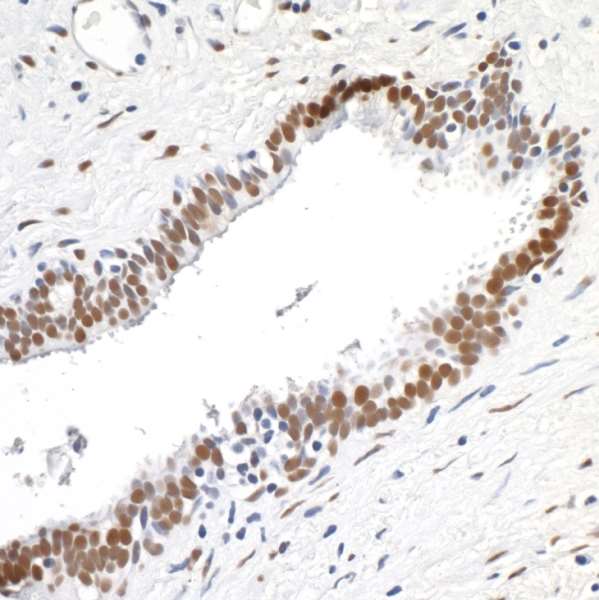 Immunohistochemistry (Formalin/PFA-fixed paraffin-embedded sections) - Anti-TLS/FUS antibody [BLR023E] (AB243880)