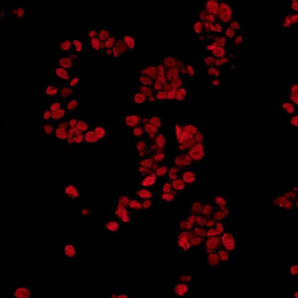 Immunocytochemistry/ Immunofluorescence - Anti-TLS/FUS antibody [BLR023E] - BSA free (AB272077)