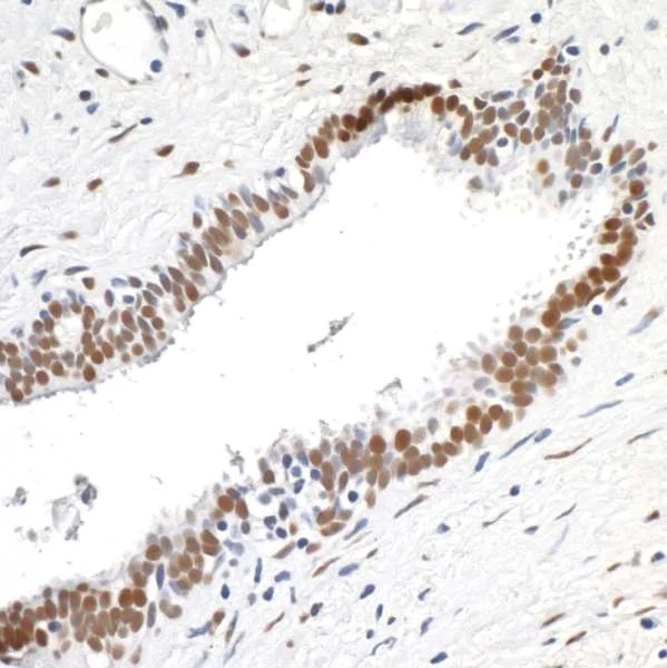 Immunohistochemistry (Formalin/PFA-fixed paraffin-embedded sections) - Anti-TLS/FUS antibody [BLR023E] - BSA free (AB272077)